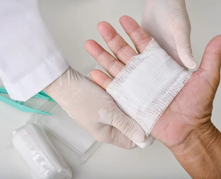 Doctor doing wound dressing care and bandaging patient's hand, Hand surgery treatment