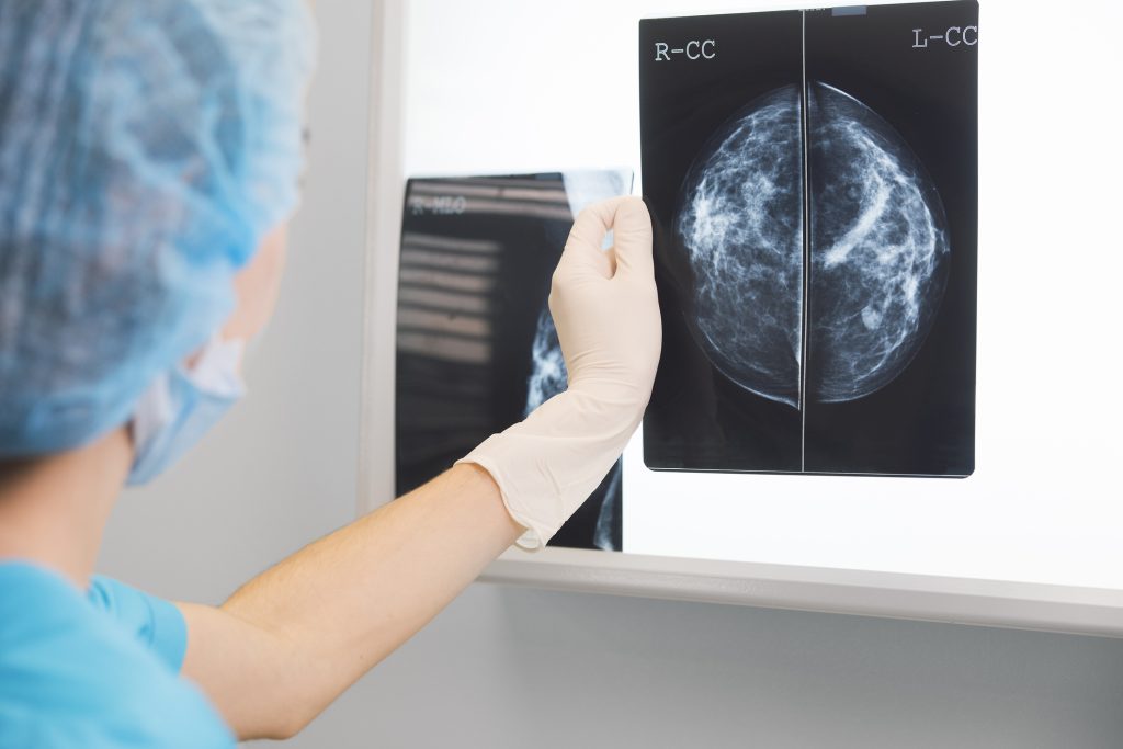 Healthcare provider reviewing mammogram imaging results