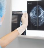 Healthcare provider reviewing mammogram imaging results