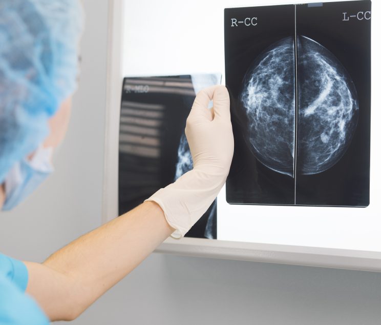 Healthcare provider reviewing mammogram imaging results