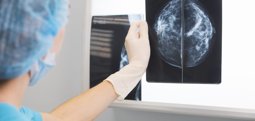 Healthcare provider reviewing mammogram imaging results